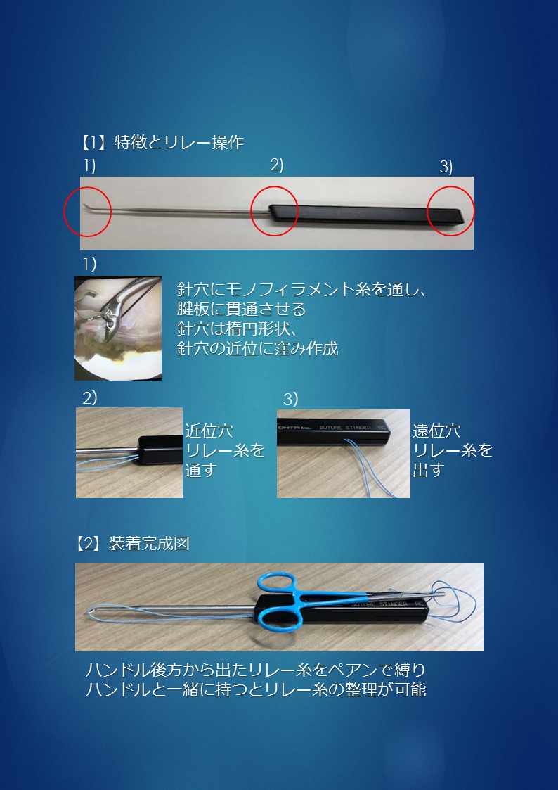 スーチャースティンガーRC